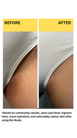 Rei-Nude Ingrown Hair Serum